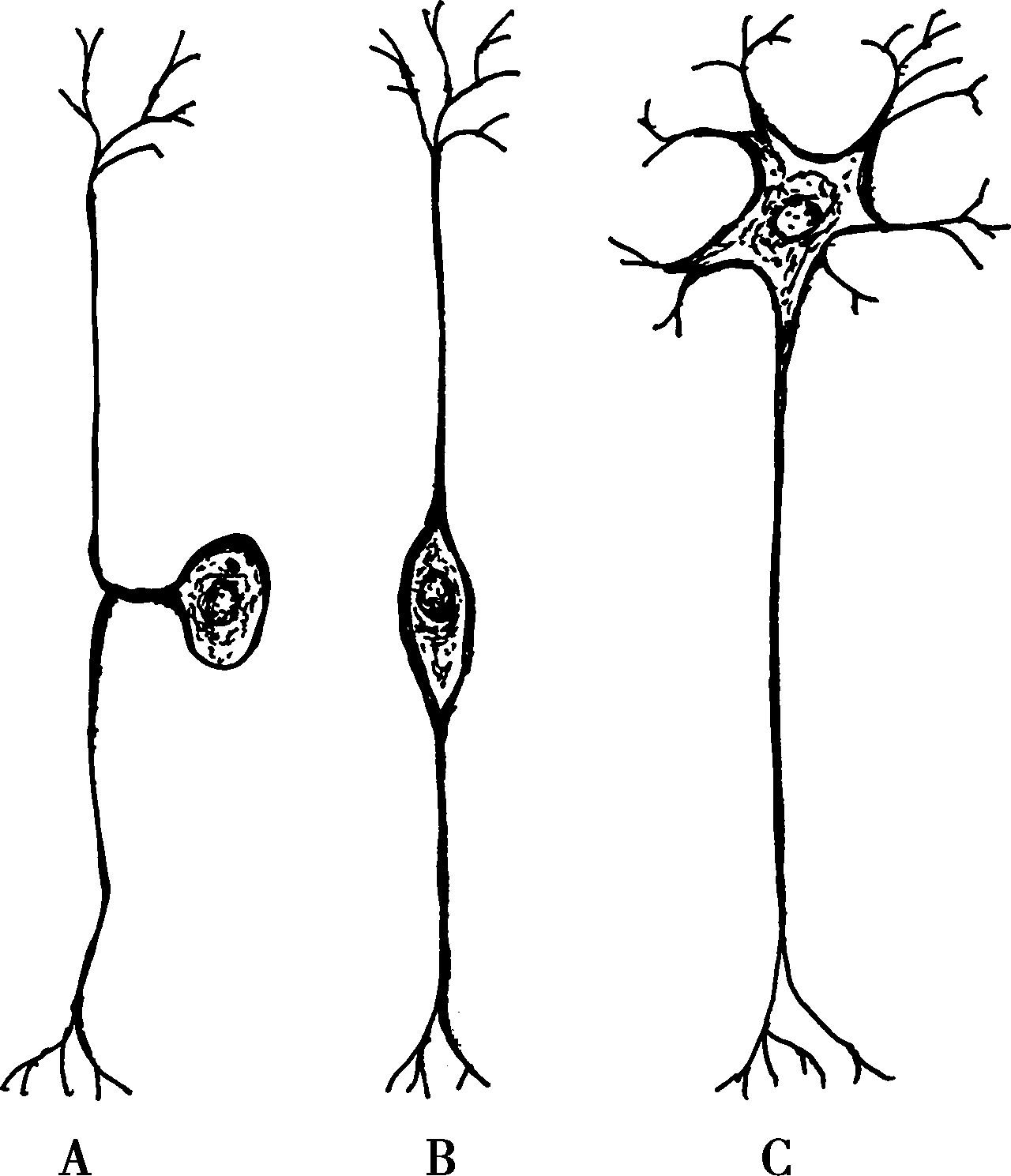 如脊神经节和三叉神经节感觉神经元,其特点是胞体发出一个突起,然后