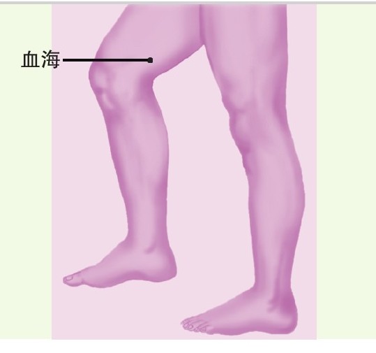 figure_0078_0050