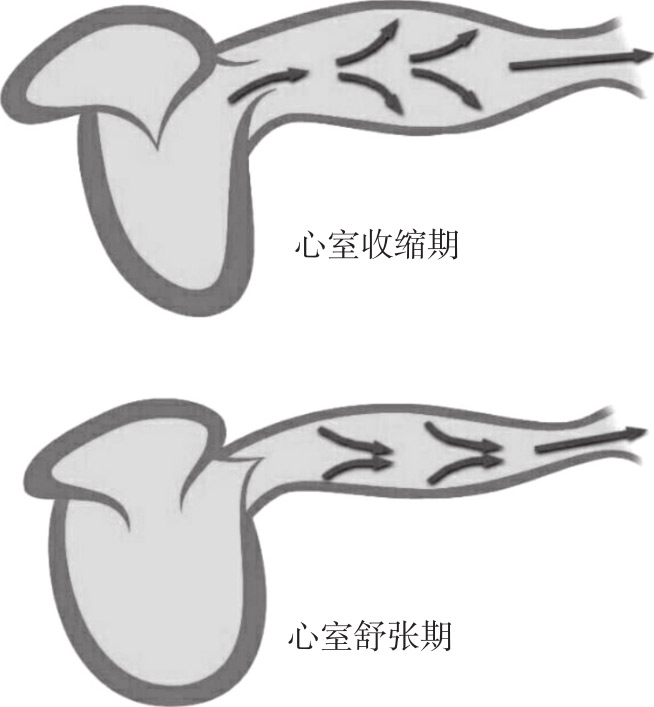 图4-8 大动脉弹性作用