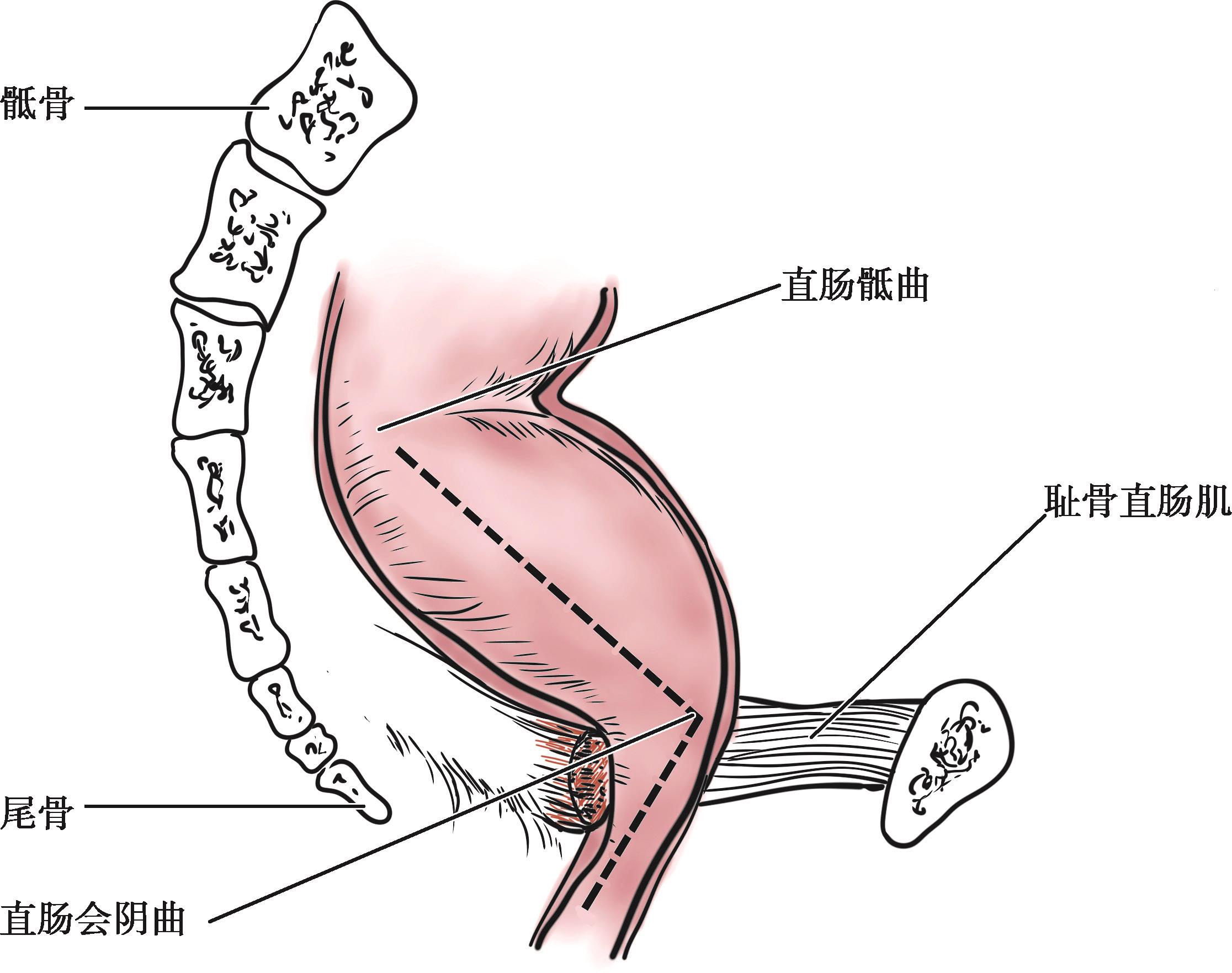 直肠矢状位解剖图片