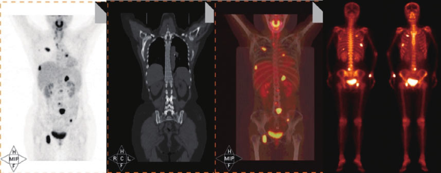 非小细胞肺癌最新章节_陆舜著