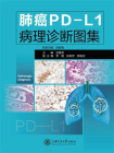 肺癌PD-L1病理诊断图集[精品]