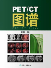 PET.CT图谱