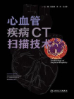 心血管疾病CT扫描技术