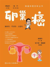 卵巢癌