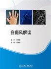 白癜风解读[精品]
