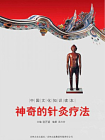 中国文化知识读本：神奇的针灸疗法