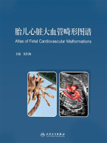 胎儿心脏大血管畸形图谱