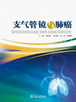 支气管镜与肺癌