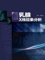乳腺X线征象分析