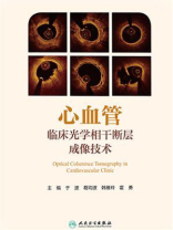 心血管临床光学相干断层成像技术