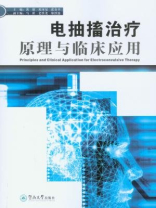 电抽搐治疗原理与临床应用
