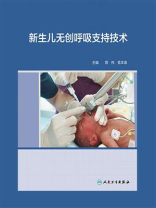 新生儿无创呼吸支持技术