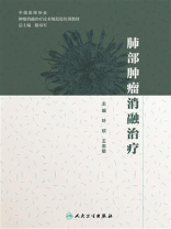 肺部肿瘤消融治疗