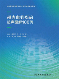 颅内血管疾病超声图解100例
