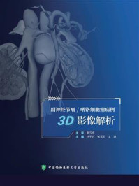 副神经节瘤.嗜铬细胞瘤病例3D影像解析