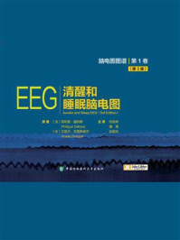 清醒和睡眠脑电图