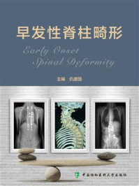 早发性脊柱畸形
