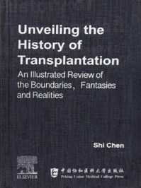 Unveiling the History of Transplantation