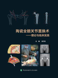 陶瓷全髋关节置换术：理论与临床实践