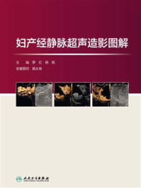 妇产经静脉超声造影图解
