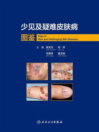 少见及疑难皮肤病图鉴