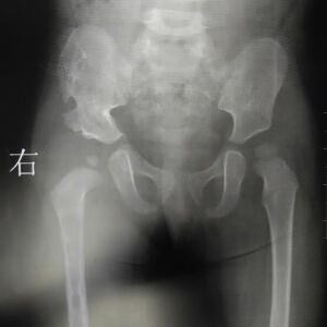 峰和1