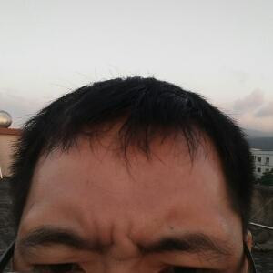鱼骨刺